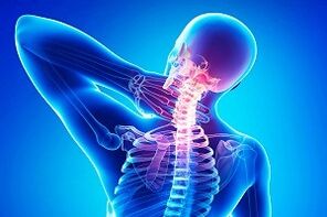 dhimbja e shpinës si simptomë e osteokondrozës
