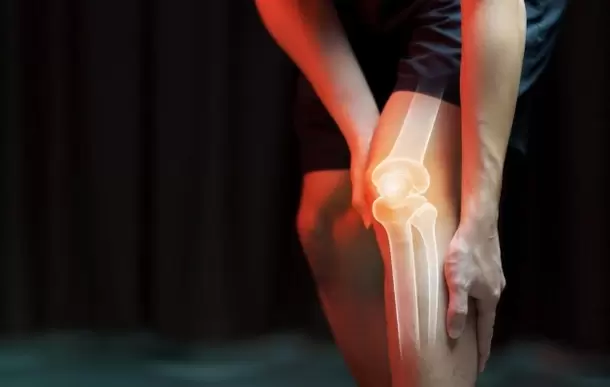 artroza e gjurit