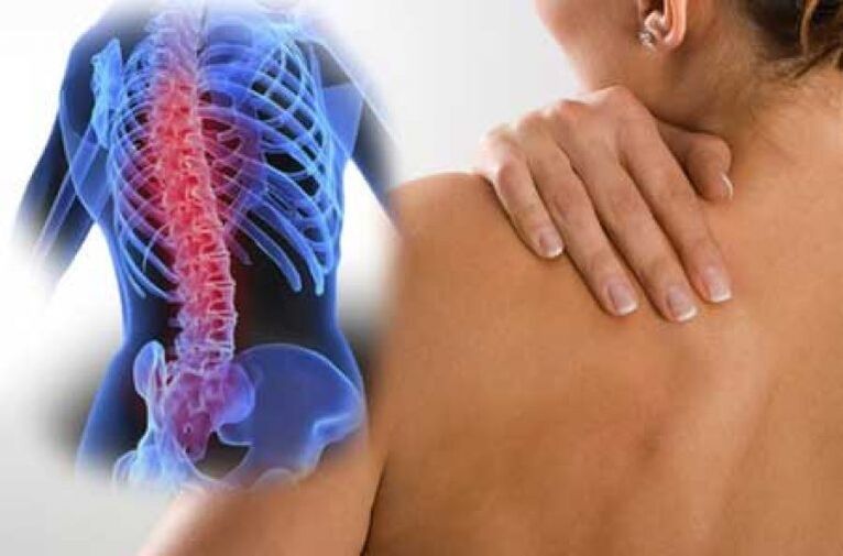 Gjatë një përkeqësimi të osteokondrozës së shpinës torakale, shfaqet dhimbja dorsago