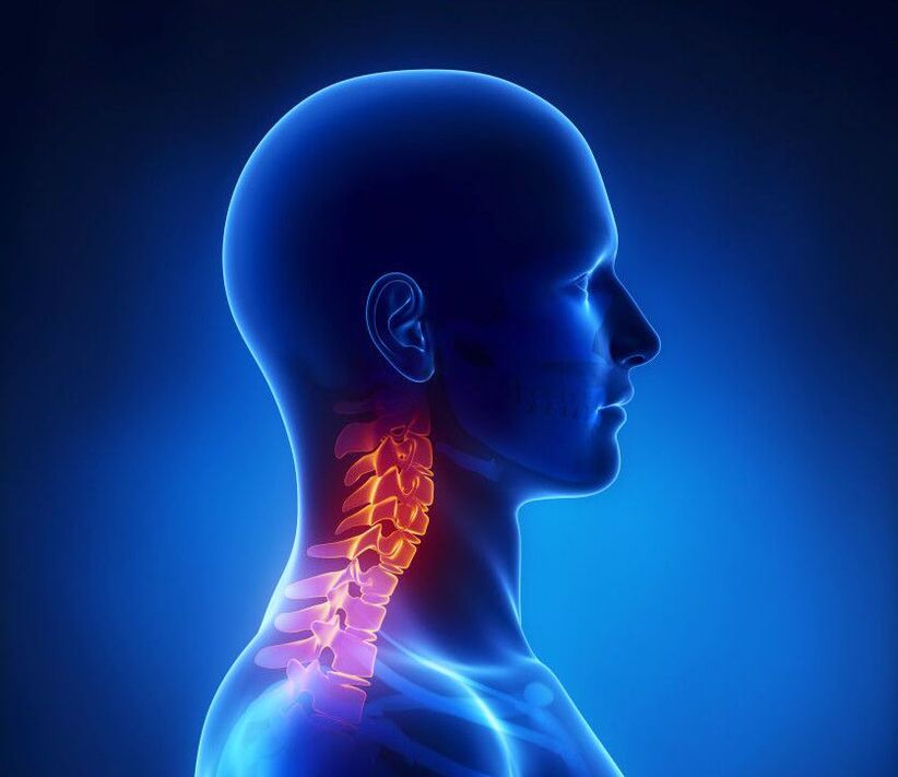 Osteokondroza e qafës së mitrës është një patologji e shtyllës kurrizore, nga e cila mund të shpëtoni në shtëpi