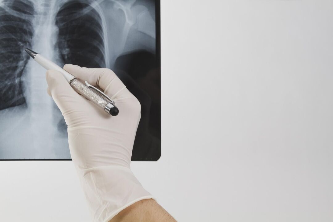 X-ray për diagnostikimin e osteokondrozës