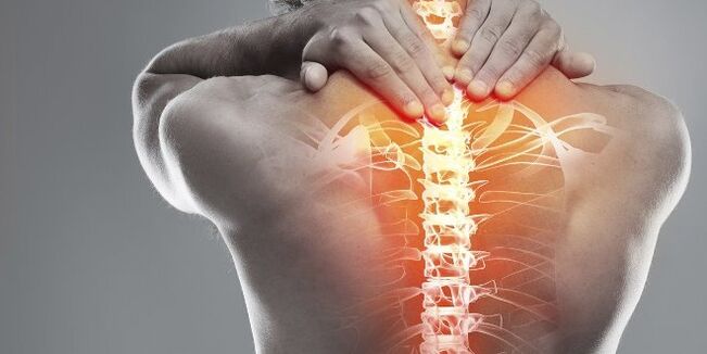 Opsione mjekësore për terapi të qafës së mitrës së osteokondrozës së qafës së mitrës